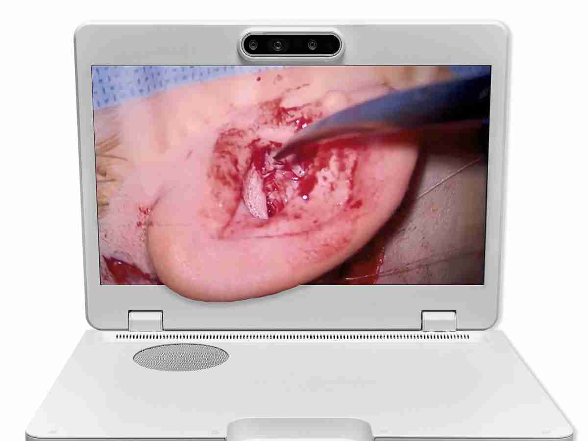 达擎之＂Heads-up 3D显微手术显示系统＂，，，整合4K裸眼3D显示及眼球追踪系统，，具备快速追踪人眼移动位置功能，，减轻医师长时间维持固定姿势的负担，，，，让医师能有更宽广清晰的3D立体视野及更舒适的姿势来执行手术。。。。